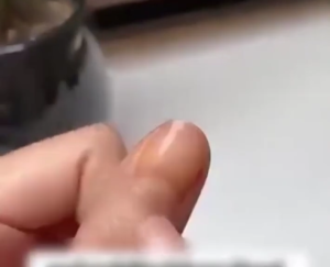 Best Seller FUNGAL NAIL PATCHES | Overnight Nail Repair | Improves Nail Discoloration | Fortifies Battle Nails | Strengthens Weak Nails | Overnight Repair for Healthier Nails | Treats Fungal Infection | Combats Infections Toe Nail | Renews Nail Structure.