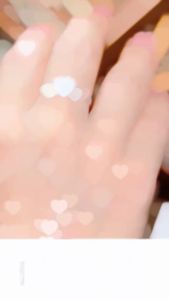 Tinh Chất Xóa Thâm Nám Tàn Nhang 377 – Xịt Melanin 377 Xóa Nám Tàn Nhang Tẩy Sạch Sạm Da Làn Da Sáng Rạng Ngời