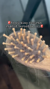 TERRA DIVERDE energizing action lotion 10ml \ serum rambut|penumbuh rambut|hair tonic