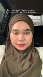 Glad2Glow Centella Salicylic Acid Power Clear Acne Serum 17ml Acne Treatment Medication Prevent the Growth of Jerawat