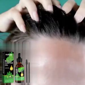 OUHOE Black Castor Oil Hair Growth Liquid Prevent Hair Loss Fast Growing Treatments Germinal Liquid For Men Women Apply To Eyelashes And Browsfor Thicker Longer And Fuller Lashes And Brows Suitable For Hair Eyebrows And Eyelashes Growth