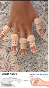 Trigger Finger Trigger Thumb Splint Pelurus jari