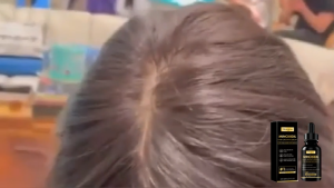 【BUY 1 TAKE 1】Minoxidil 5% Hair Growth Serum Hair Care Essence Nourishing Stronger Hair Root Anti Hair Loss  Hair Regrowth Beard Growth 60ml