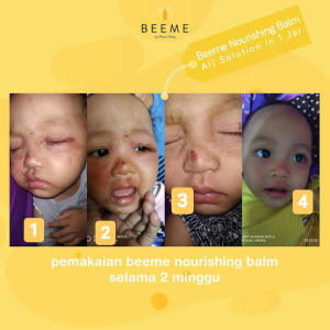 skincare bayi glowing bme