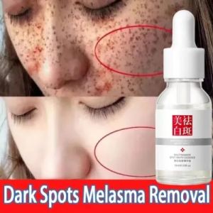 Whitening Essence Serum Remove Freckle Fade Dark Spot Anti-aging Whiten Facial Moisturize Serum / Serum Whitening / Serum Wajah Glowing / Serum Jerawat Dan Bekasnya / Glowing / Penghilang Flek Hitam