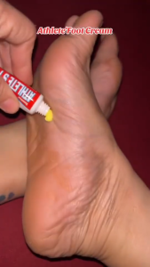 Foot Anti-Fungal Athletes Foot Cream Deodorant Cream Anti-Itch Odor Removing Beriberi Ointment 20g For Itchy Odor Removal Beriberi Treatment Moisturizing Ointment Easily Remove Athletes Foot And Foot Odor Caused By Fungal Infection