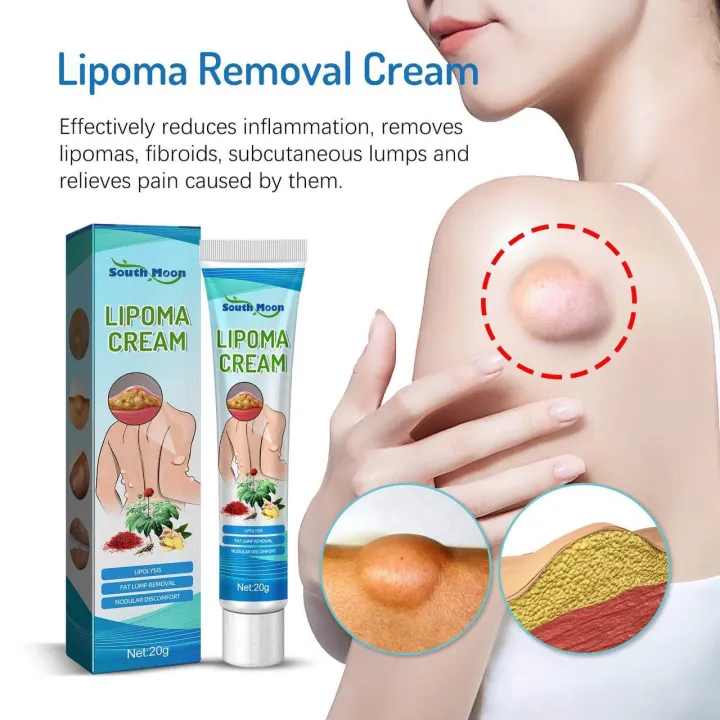 SOUTHMOON%20LIPOMA%20REMOVAL%20CREAM%20krim%20pembersih%20lipoma%20limfa%20ketulan%20keras%20ketiak%20leher%20belakang%20telinga%20buang%20detox%20badan%20-%20Image%204