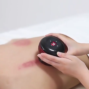 5 In 1 Electric Cupping Set Gua Sha Cupping Set With Remote Control 12 Levels Adjustable Temperature Vacuum Cupping Massager With Red Light Suitable For Body 3 Cups To Relieve Muscle Pain (Red)