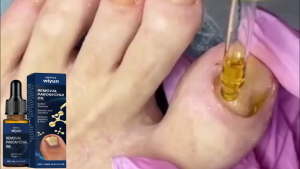 Nail Care Cuticle Oil - Melembapkan & Perbaiki Kutikula Cegah Kuku Kering & Rusak Untuk Kuku Lebih Kuat dan Berkilau 10ml