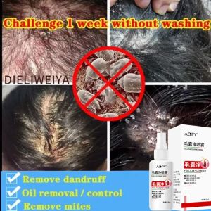 Hair Scalp Treatment Spray Remove Dandruff Itching Oil Control Anti Loss Scalp Cleaning Repair Serum Beauty Hair Care Products