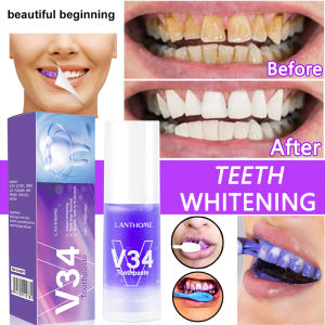 Teeth Whitening Toothpaste  Tartar Removal pampaputi ng ngipin  Not irritating  Treat bleeding gums fresh breath 30ml