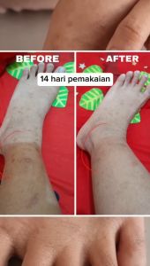 Lalotuskin Triple Booster Whitening