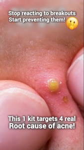 (VEMONTES OFFICIAL STORE) Axcne Booster Ampoule (1 Box = 3ml x 10 Bottles) - COCOMO