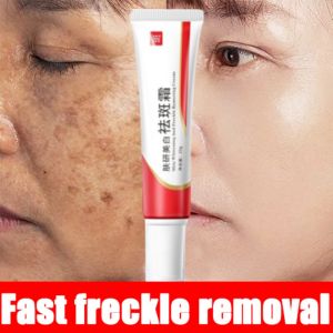 [HOT! 3PCS] 20g Houmai Melasma Removal Skin Whitening And Anti-Freckle Removing Cream Limited Offer 100% Original COD