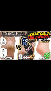 [SG Stock] Pro Electric Foot Grinder | 9-Speed Adjustable Callus Remover with LED Display | 3000mAh Battery & Alloy Body | Professional Pedicure Tool for Dead Skin & Calluses