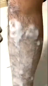 60g Hair Removal Cream Easy Hair Removal Arms Legs Underarms Bikini Line Remove Excess Hair In Specific Areas Prevent Hair Regrowth Brighten Skin Moisturize Skin Prevent "Chicken Skin"