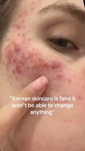 Medicube Collagen Jelly Cream 110ml / MEDICUBE Collagen Niacinamide Jelly Cream 110g