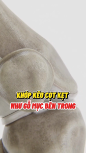 Anbone hỗ trợ cải thiện đau nhức khớp - Sản phẩm chính hãng của Traphaco (hộp 30 viên)