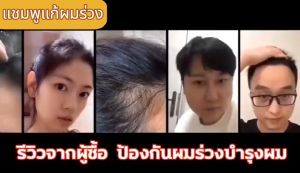 ปรับปรุงสภาพ ผม ซัพพลาผู้ชาย บำรุงรากผม ยาสระผมแก้ร่วง ซึ่งเป็นปรับปรุงคุณภาพ และผมยาว ซึ่งสามารถปรับปรุงได้ในการพัฒนา และปรับปรุงสภาพผมได้อย่างสม่ำเสมอ