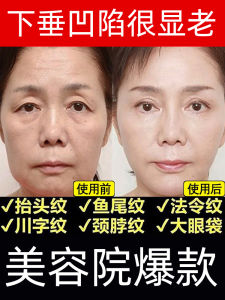 Dofeni Peptide Collagen Protein Powder Cream Anti-Wrinkle Firming Facial Skin Care Product for Loose Sagging Skin Fine Lines