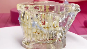 Dental Implant Model Teeth Model Tooth Dentist For Dental Disease Teaching Study Tool