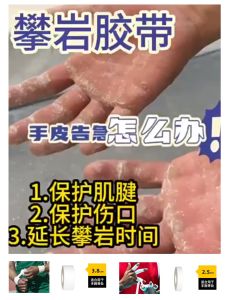 Dây Đeo Ngón Tay Leo Núi Thể Thao Chống Trượt Chuyên Dụng Cho Thể Thao Và Thể Dục Băng Dính Bao Quanh Tay