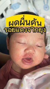 Mamoon ผงสมุนไพรอาบน้ำสำหรับเด็ก - ผงขมิ้นอาบน้ำเด็ก ลดผดผื่นคัน เจ้าแรก Mamoon