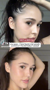 [SG official spot] Nourkrin HAIR GROWTH+ INCLINIC 90 Tablets 生发胶囊