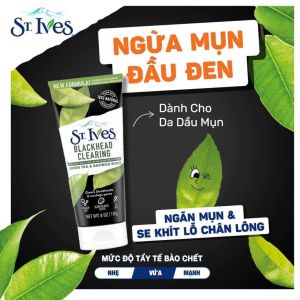 [NHẬP KHẨU] Sữa rửa mặt tẩy tế bào da chết St.Ives 170g