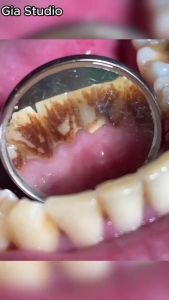 BUY I TAKE 2 Whitening Toothpaste Peppermint Food Graded Family Baking Soda Fresh Minty Toothpaste