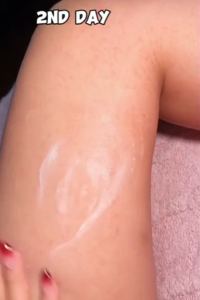 12 PCS COD Miaojia Zudaifu Skin Herbal Psoriasis Dermatitis Eczema Pruritus Psoriasis Cream Ointment 100%original