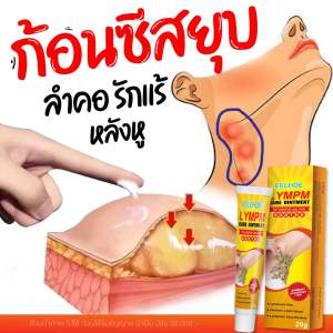 ครีมสลาย ก้อนซีส ก้อนเนื้อ ก้อนไขมัน ยุบฝ่อสลาย ลงได้เร็ว ขนาด 20 กรัม ( 2 หลอด)