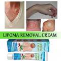 SOUTHMOON LIPOMA REMOVAL CREAM krim pembersih lipoma limfa ketulan keras ketiak leher belakang telinga buang detox badan. 
