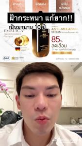 Yanhee Red Energy Lifting Serum ยันฮี เรด เอเนอร์จี้ ระดับตัวเอง สำรองเสริมความงามและร่างกาย / Yanhee Anti Melasma ยันฮี แอนตี้ เมลาสม่า ซีรั่ม [1 ขวด] [30 ml.]