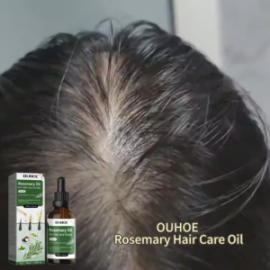 Rosemary Oil For Hair Growth Serum Rambut Gugur Serum Lebatkan Rambut Ubat Rambut Botak Hair Loss Tonic Hair Care LMO