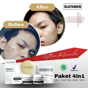 SKINCARE VIRAL PRIA!!! 4in1 Paket Skincare BPOM Glutamen Bright Active Serum Pemutih Kulit Wajah Ampuh Permanen