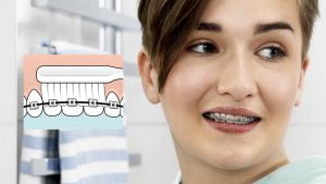 Bàn chải đánh răng chuyên biệt cho người niềng răng chỉnh nha răng implant Tepe Implant Orthodontic | Oralmart
