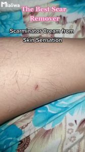 Ultimate Skincare Solution: Scarminator Cream & Glow Tonic Toner