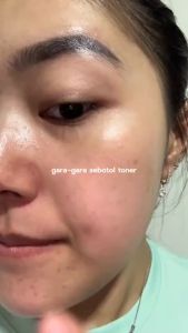 GLAD2GLOW - G2G 2% Centella Ceramide Super Sooting || Blackberry AHA BHA PHA || Propolis 5% Hyaluronic Acid Toner Cerianti Lynn Design