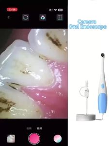 Visual Oral Endoscope Camera HD Borescope With 8LEDS Portable Oral Care Home Care System/Pet For Android USB Type-C