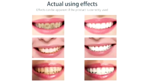 ALIVER Teeth Whitening Mousse Toothpaste Tartar Removal for Teeth Plaqu Oral Odor Whitening Teeth