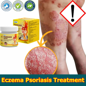 Itchy Skin Relief Cream Antibacterial Cream 20g Skin Anti Itch Cream For Skin Quick Itching Relief Ubat Celah Kangkang Gatal Private Parts Antifungal Cream Anti-Itching Cream Eczema Psoriasis Cream 3 Seconds Of Rapid Itch Relief Safe And Effective