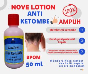 NOVE LOTION RAMBUT ANTI KETOMBE - Menuntaskan Masalah Ketombe Lebih Cepat 50ml