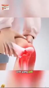 Joint Soothing Massage Gel Relieve Shoulder Back Wrist Knee Soreness，Deep Penetration Joint Care Gel Repair Worn Cartilage Lubricate Joints