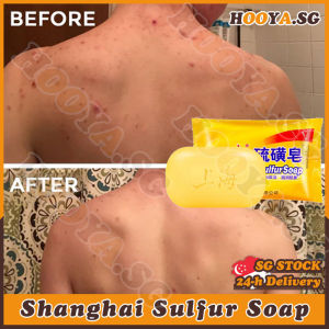 ✅SG Stock✅ Shanghai sulfur soap bar / Skin acne psoriasis eczema / Oil control anti fungus soap / Bath healthy soap / 上海硫磺皂