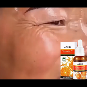 Vitamin C Serum 30ML Brightening Essence - Menghilangkan Flak Hitam Bintik Bintik dan Melasma di Wajah - MOISTURIZED - IMPROVE FINE LINES - REPAIR BARRIER
