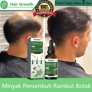 Rosemary Hair Growth Oil Rosemary Oil Penumbuh Rambut Anti Hair Loss Products Fast Regrowth Essential Oil Repair Scalp Frizzy Thinning Damaged Hair Care 50ML