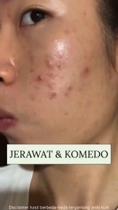 PROMO SPESIAL!!! CARECOAL Black Soap - Sabun Pencerah Dan Penghilang Noda Hitam Pada Wajah