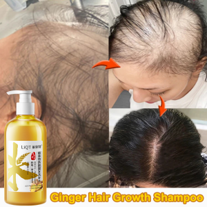 hair loss shampoo Hair growth shampoo Ginger shampoo Moisturize hair prevent hair loss Anti dandruff/Control oil Promote hair growth