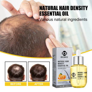 เซรั่มน้ำมันหอมระเหยน้ำยารักษาหนังศรีษะซ่อมแซมเส้นผม 30 มล สารสกัด ประหลัก สุขภาพ สุขสิทธิ์ สกัดผมประสงค์ สกัดผมประสงค์ 30 มล